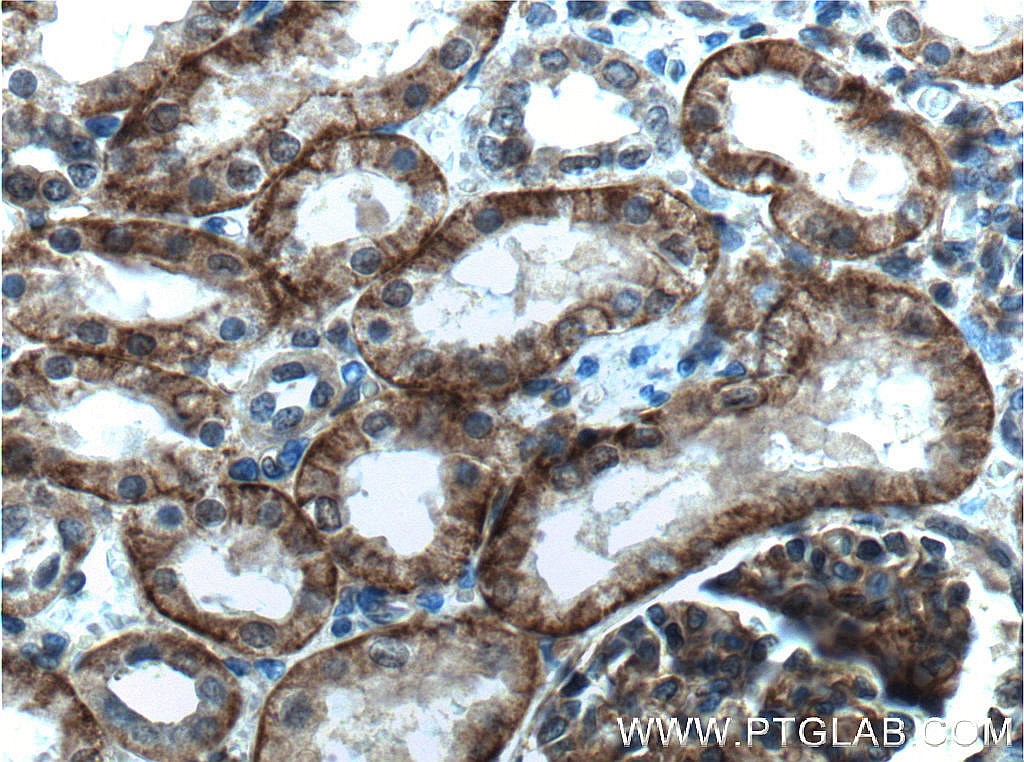 Immunohistochemistry (IHC) staining of human kidney tissue using Nectin-2/PVRL2 Polyclonal antibody (27171-1-AP)