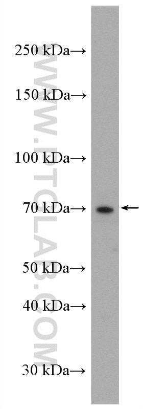 WB analysis of Jurkat using 27171-1-AP