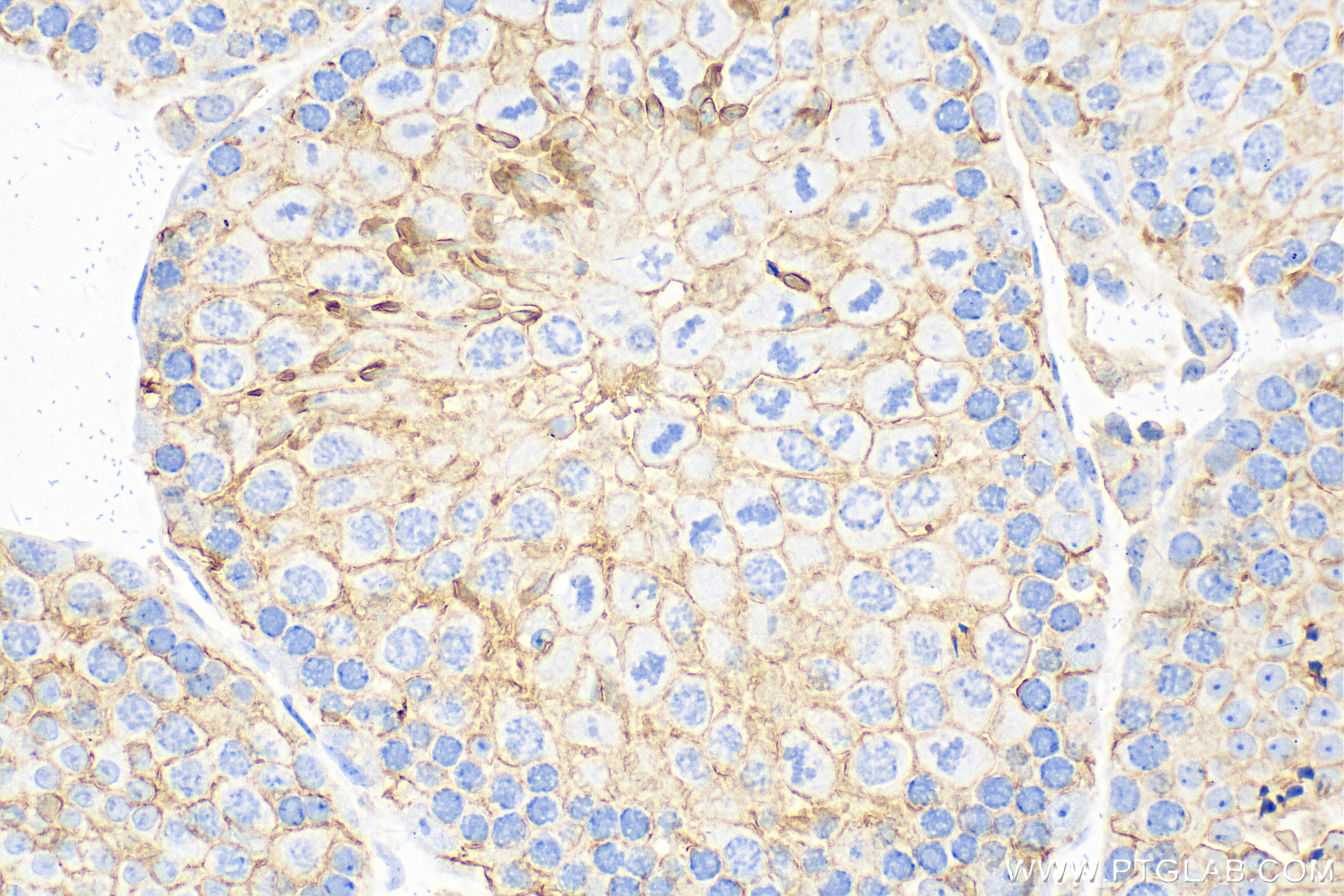 Immunohistochemistry (IHC) staining of mouse testis tissue using Nectin-2/CD112 Polyclonal antibody (32147-1-AP)