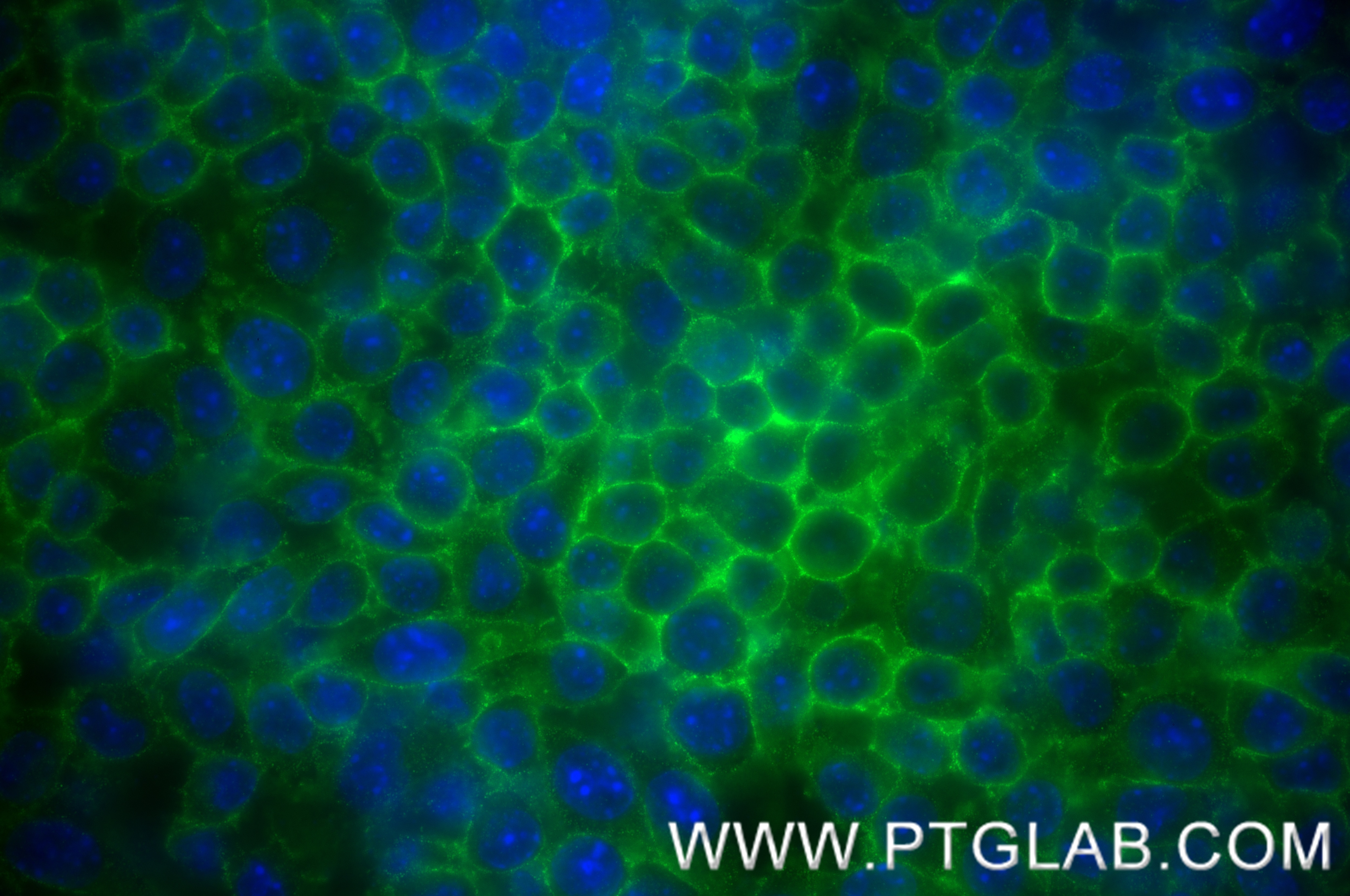 Immunofluorescence (IF) / fluorescent staining of RAW 264.7 cells using Nectin-2/CD112 Recombinant antibody (84439-6-RR)