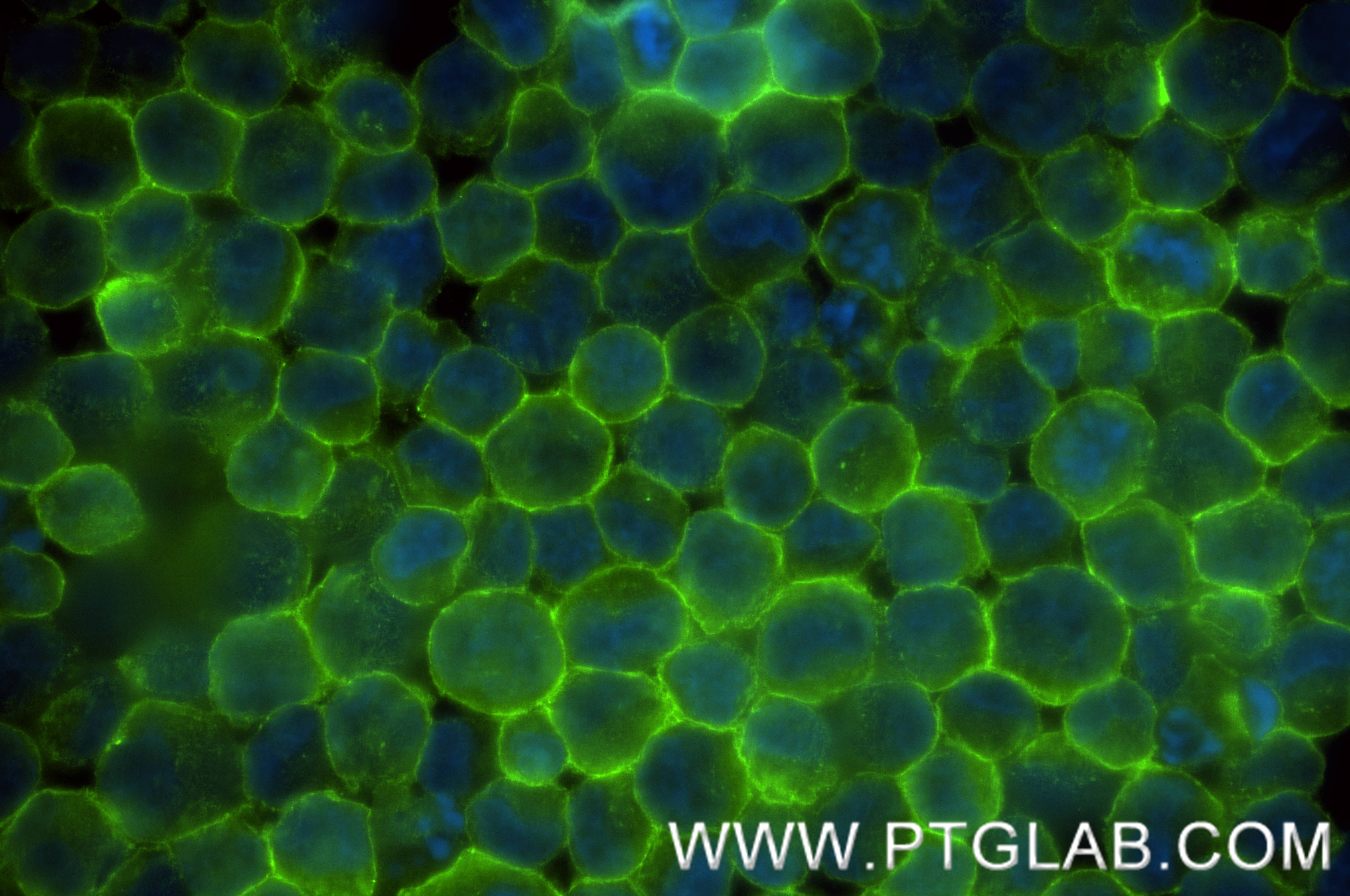 Immunofluorescence (IF) / fluorescent staining of K-562 cells using Nectin-2/CD112 Recombinant antibody (84460-5-RR)