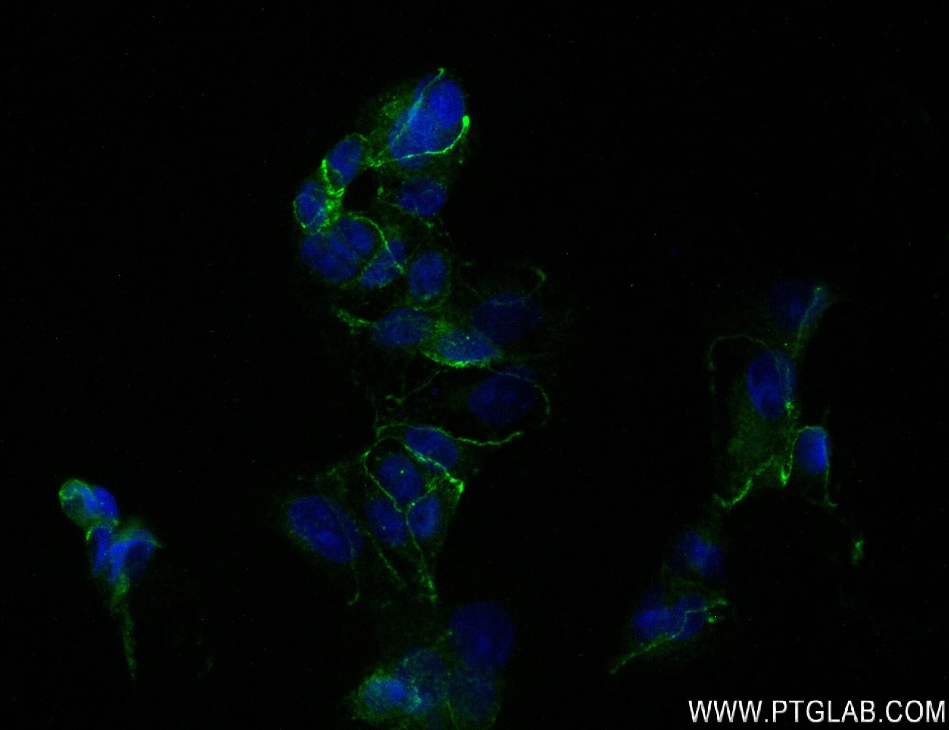 Nectin-4/PVRL4