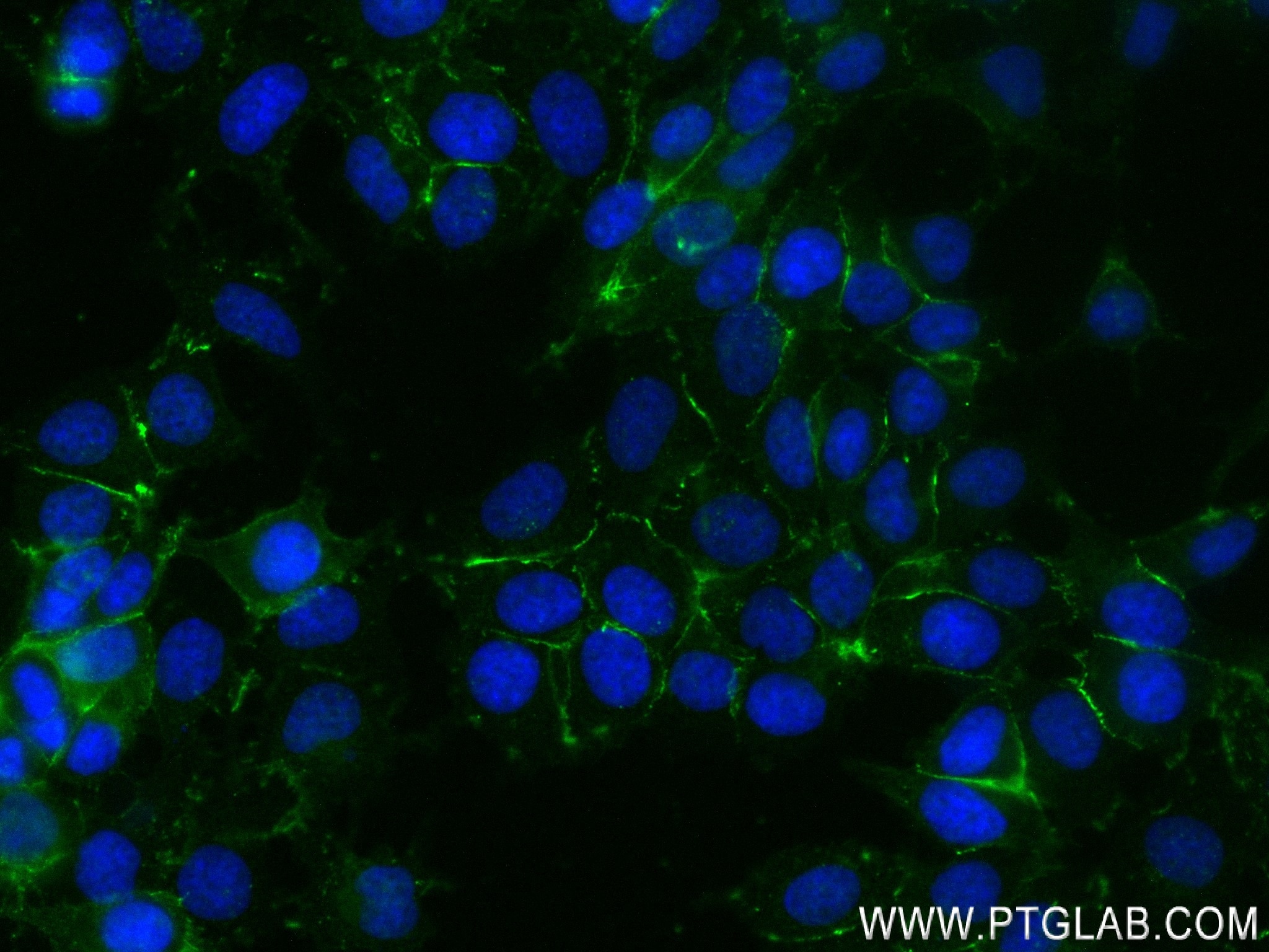 Immunofluorescence (IF) / fluorescent staining of MCF-7 cells using Nectin-4/PVRL4 Recombinant antibody (83223-4-RR)