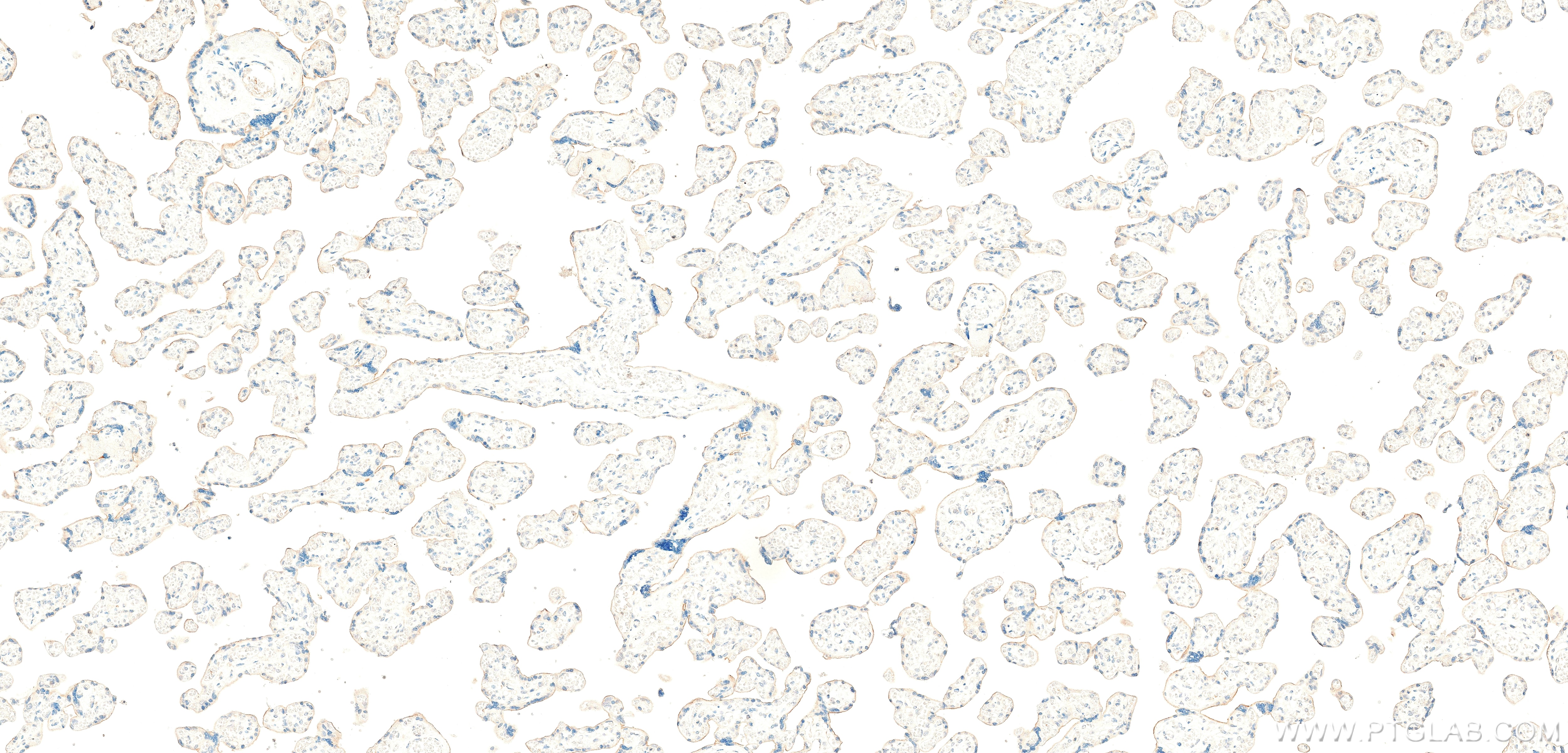 Immunohistochemistry (IHC) staining of human placenta tissue using Nectin-4/PVRL4 Recombinant monoclonal antibody (83223-4-RR)