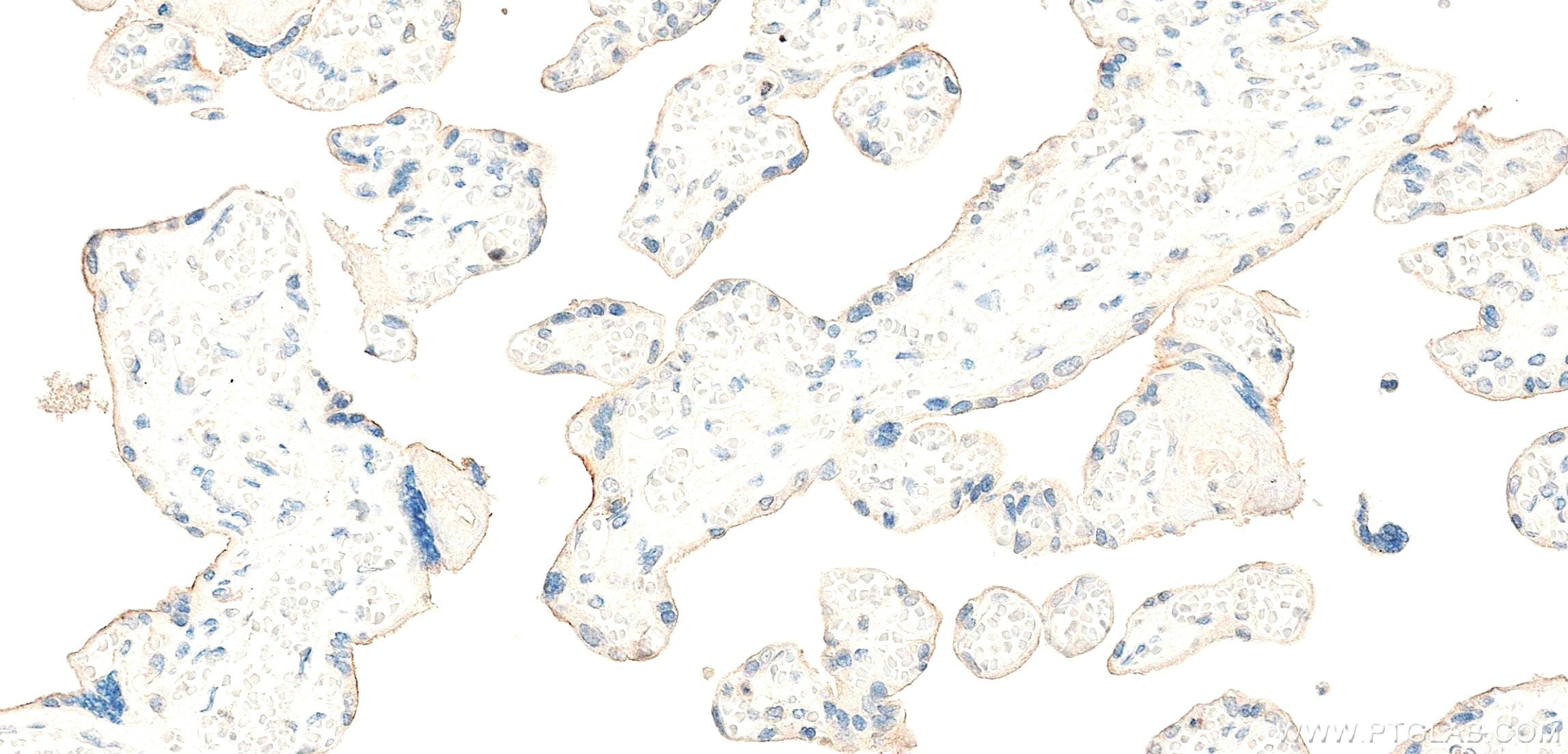 Immunohistochemistry (IHC) staining of human placenta tissue using Nectin-4/PVRL4 Recombinant monoclonal antibody (83223-4-RR)