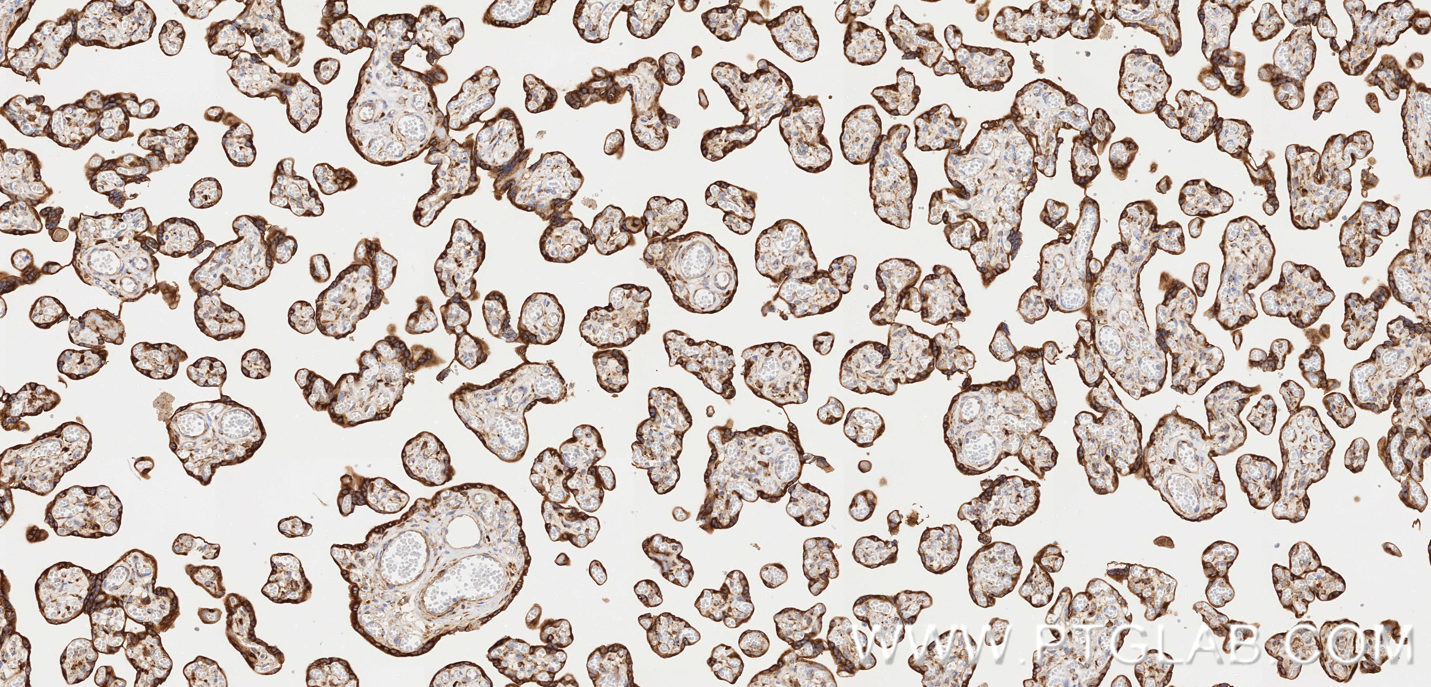 IHC staining of human placenta using 83223-6-RR Immunohistochemistry (IHC) staining of human placenta tissue using Nectin-4/PVRL4 Recombinant monoclonal antibody (83223-6-RR)