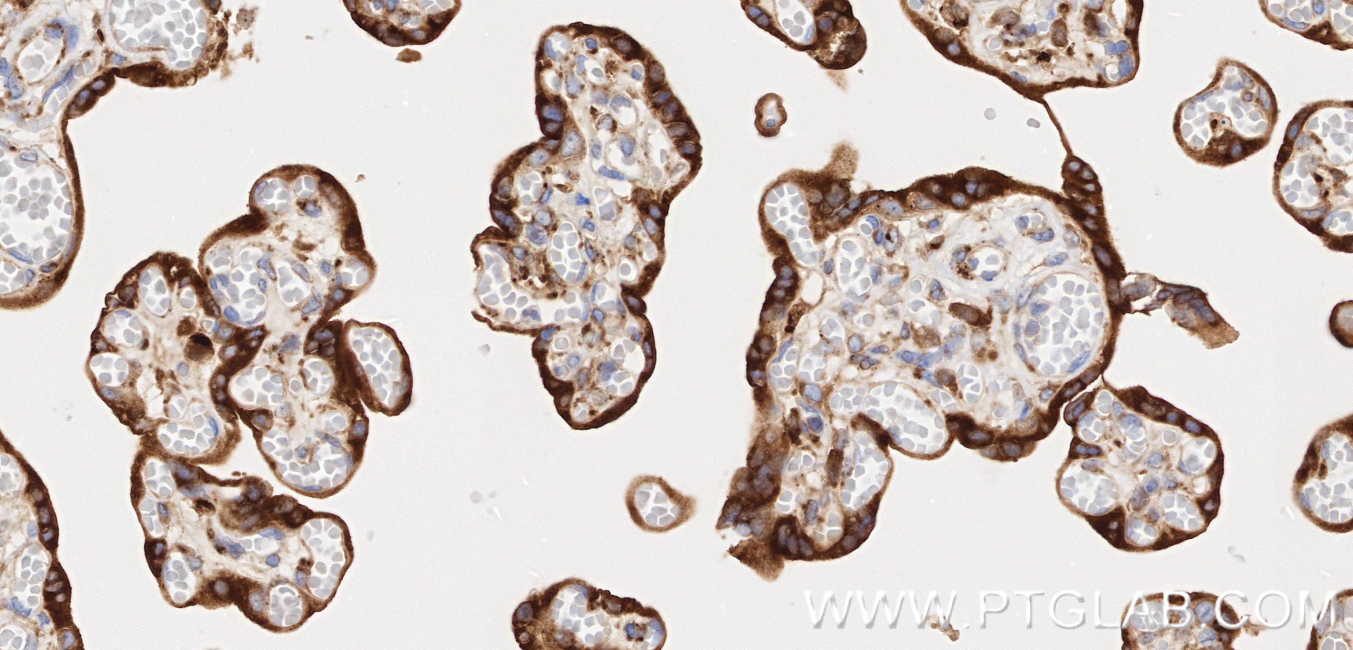 IHC staining of human placenta using 83223-6-RR Immunohistochemistry (IHC) staining of human placenta tissue using Nectin-4/PVRL4 Recombinant monoclonal antibody (83223-6-RR)