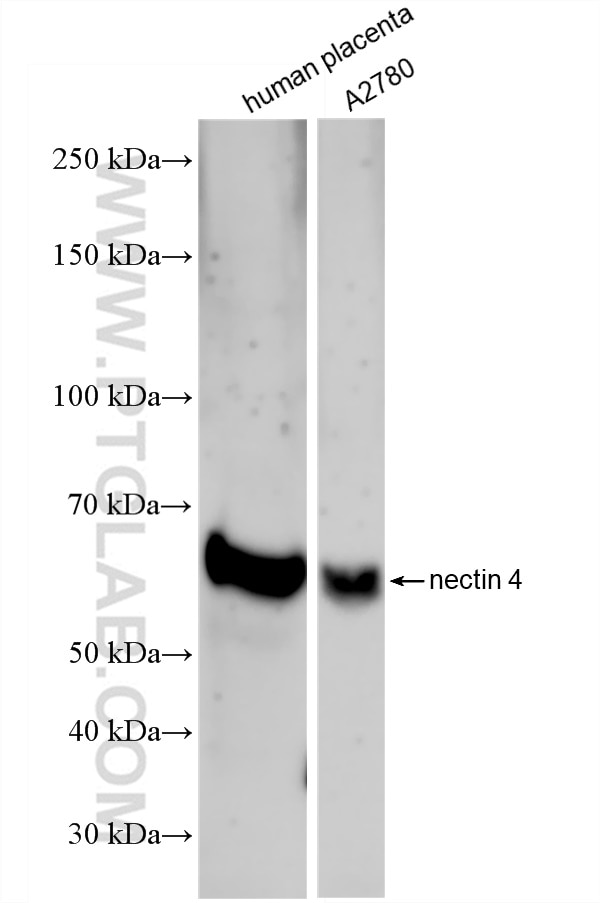 Western Blot (WB) analysis of various lysates using Nectin-4/PVRL4 Recombinant antibody (83223-6-RR)