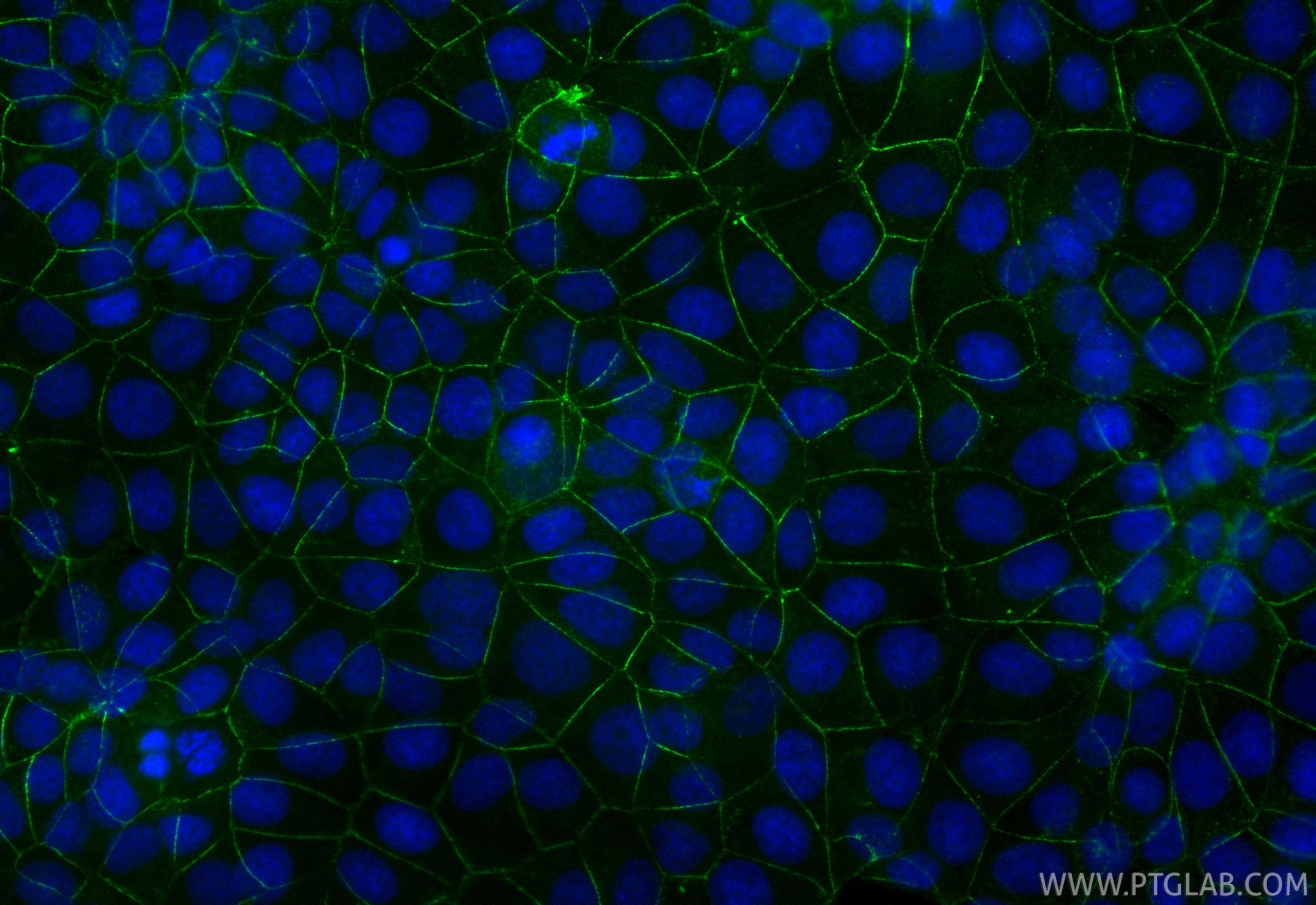 Immunofluorescent analysis of (4% PFA) fixed MCF-7 cells using CoraLite® Plus 488 Nectin-4/PVRL4 antibody (CL488-83223-4, Clone: 240009F2 ) at dilution of 1:200. Immunofluorescence (IF) / fluorescent staining of MCF-7 cells using CoraLite® Plus 488-conjugated Nectin-4/PVRL4 Recom (CL488-83223-4)