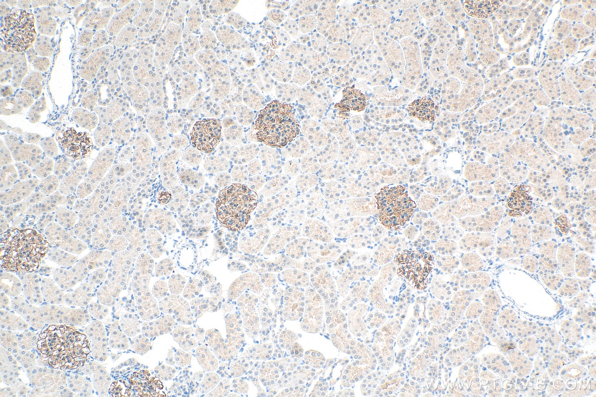 IHC staining of rat kidney using 22912-1-AP
