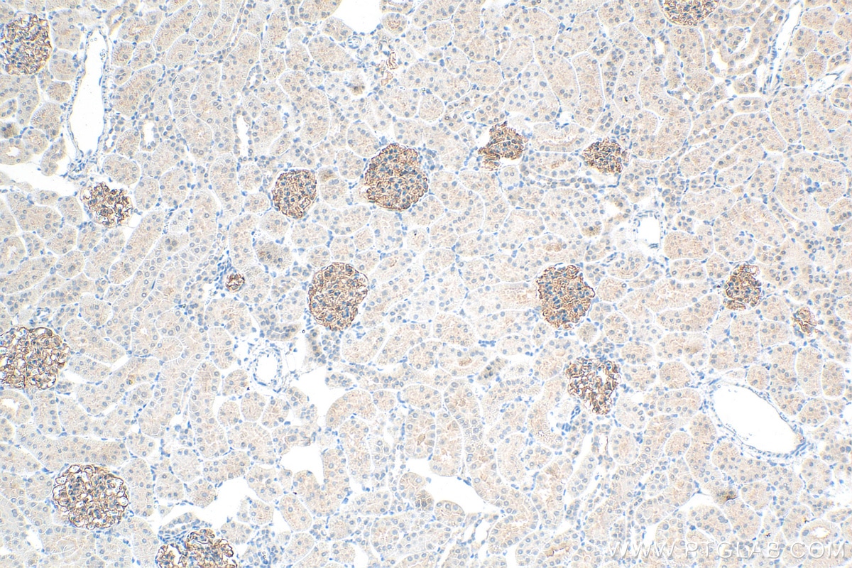 Immunohistochemistry (IHC) staining of rat kidney tissue using Nephrin Polyclonal antibody (22912-1-AP)