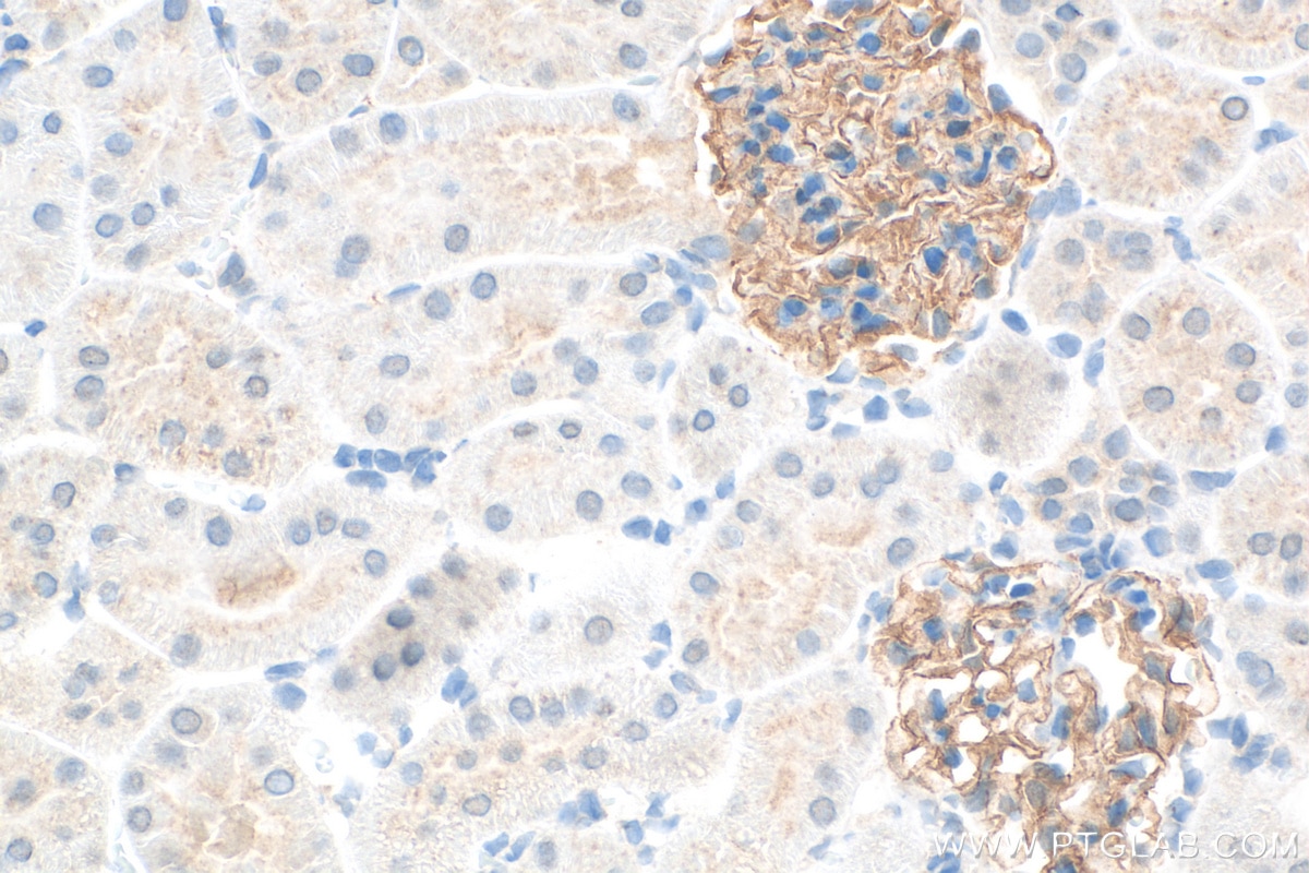 Immunohistochemistry (IHC) staining of rat kidney tissue using Nephrin Polyclonal antibody (22912-1-AP)
