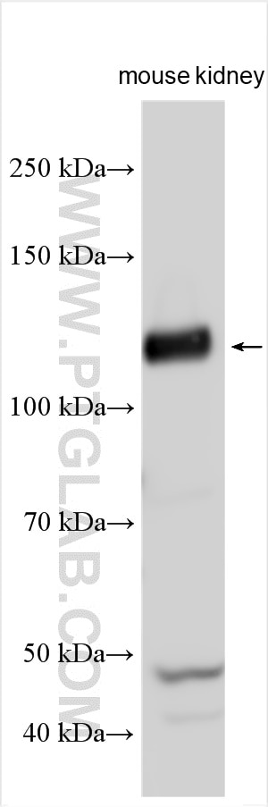 Western Blot (WB) analysis of various lysates using Nephrin Polyclonal antibody (22912-1-AP)
