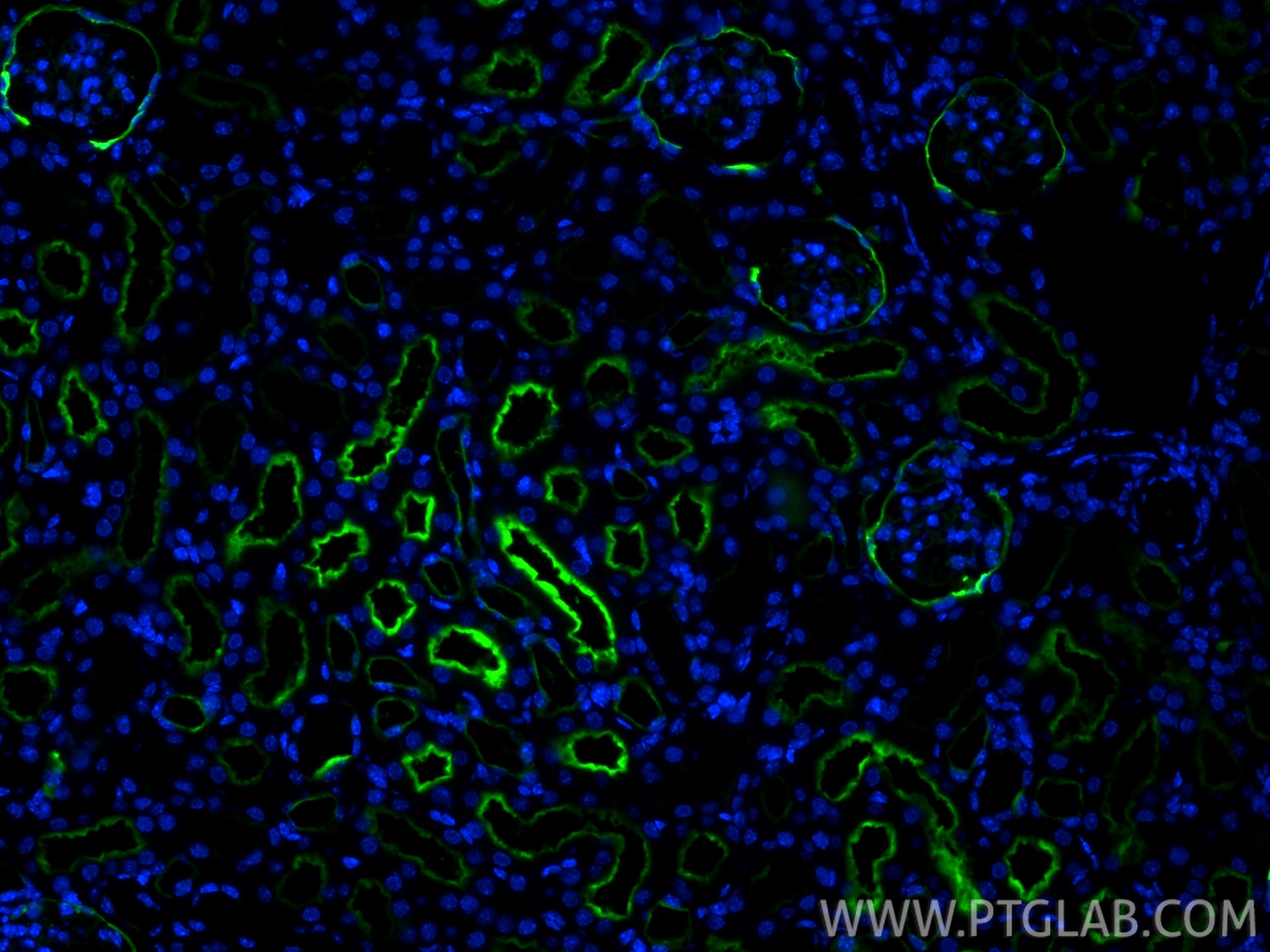 Immunofluorescence (IF) / fluorescent staining of mouse kidney tissue using Neprilysin/CD10 Recombinant antibody (84181-1-RR)