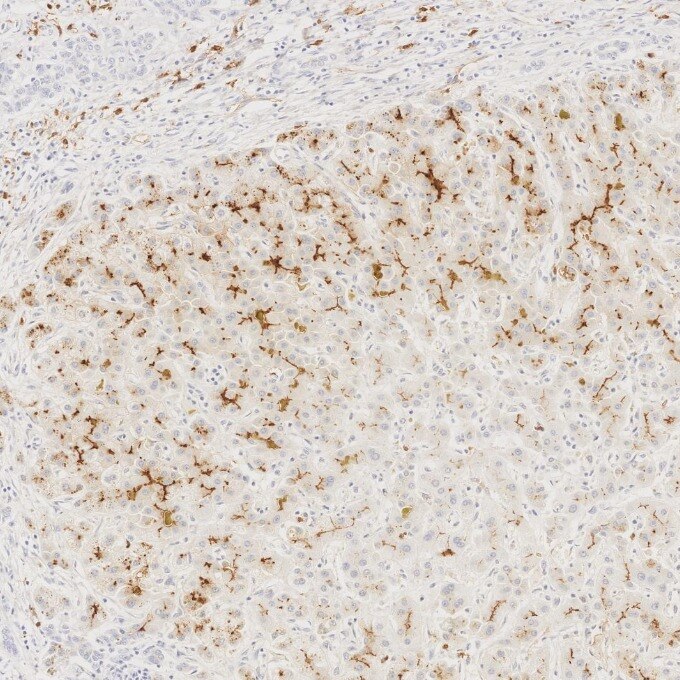 IHC staining of human liver using 84181-1-RR Immunohistochemistry (IHC) staining of human liver tissue using Neprilysin/CD10 Recombinant monoclonal antibody (84181-1-RR)