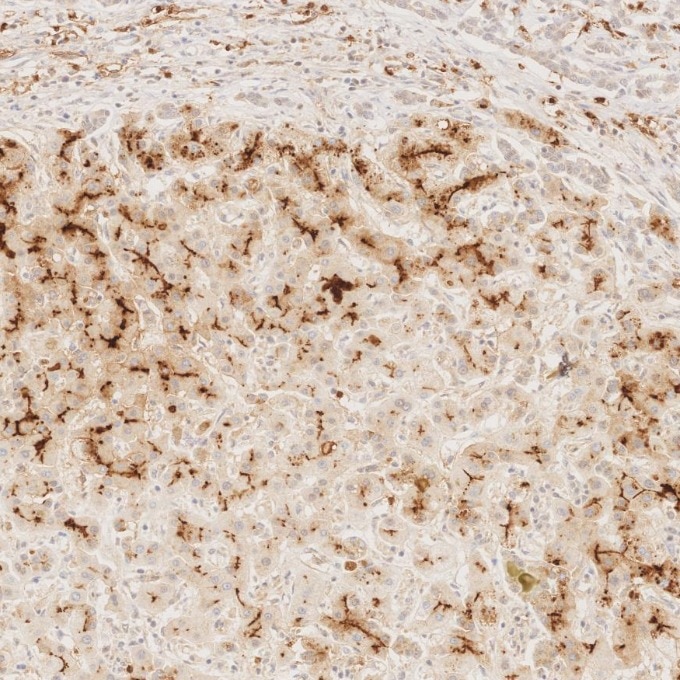 IHC staining of human liver using 84181-1-RR Immunohistochemistry (IHC) staining of human liver tissue using Neprilysin/CD10 Recombinant monoclonal antibody (84181-1-RR)