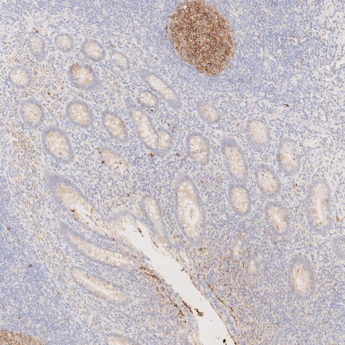 IHC staining of human appendicitis using 84181-1-RR Immunohistochemistry (IHC) staining of human appendicitis tissue using Neprilysin/CD10 Recombinant monoclonal antibody (84181-1-RR)