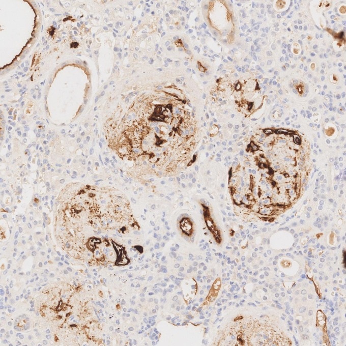 IHC staining of human kidney using 84181-1-RR Immunohistochemistry (IHC) staining of human kidney tissue using Neprilysin/CD10 Recombinant monoclonal antibody (84181-1-RR)