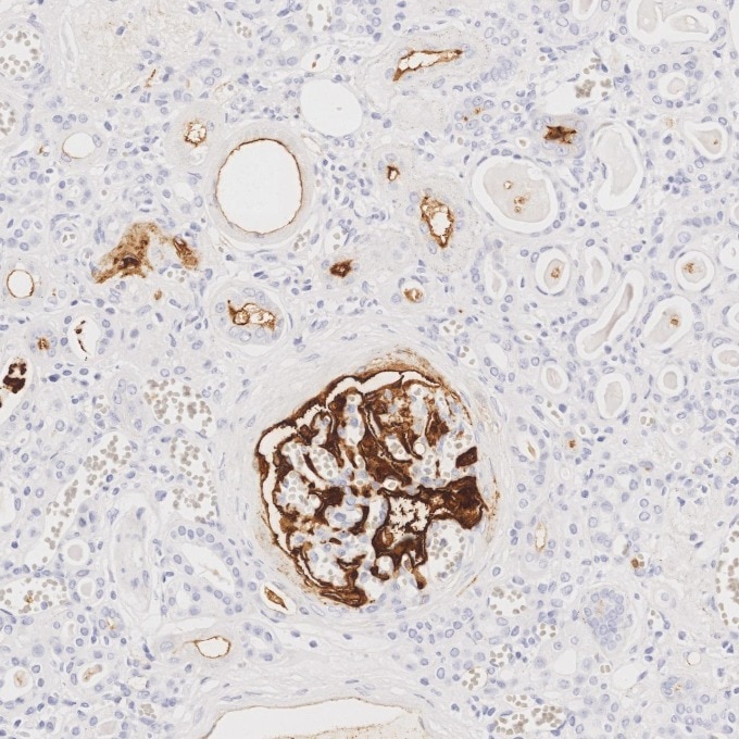 IHC staining of human kidney using 84181-1-RR Immunohistochemistry (IHC) staining of human kidney tissue using Neprilysin/CD10 Recombinant monoclonal antibody (84181-1-RR)