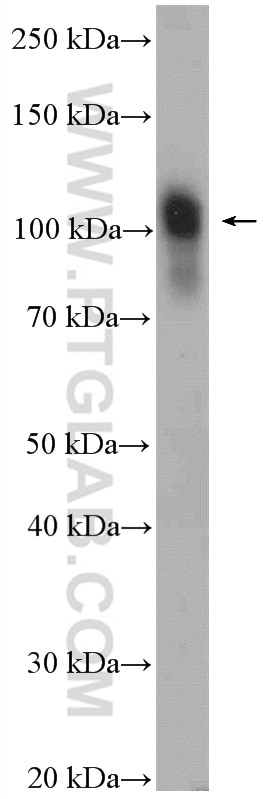 Western Blot (WB) analysis of rat spleen tissue using Nesprin 3 Polyclonal antibody (27132-1-AP)