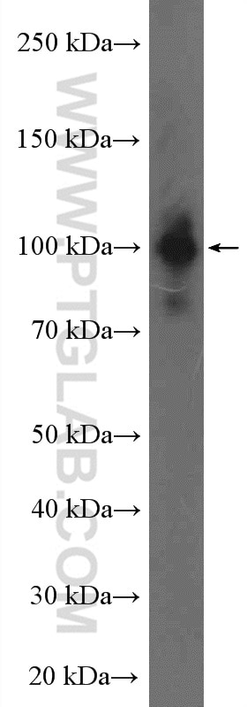Western Blot (WB) analysis of mouse spleen tissue using Nesprin 3 Polyclonal antibody (27132-1-AP)