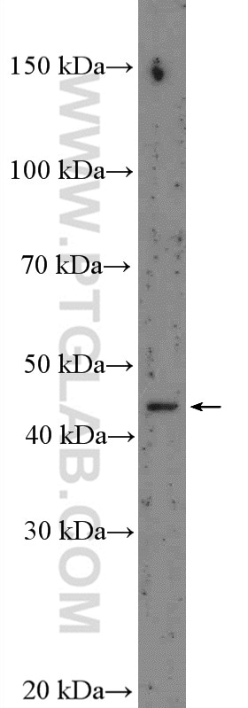 Western Blot (WB) analysis of L02 cells using Nesprin 4 Polyclonal antibody (26467-1-AP)