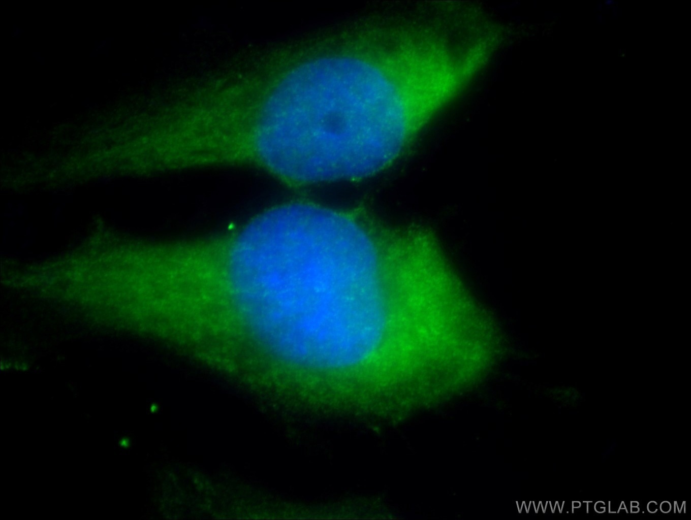 Nestin Monoclonal antibody