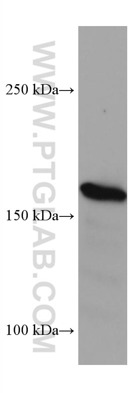 Western Blot (WB) analysis of HEK-293 cells using Nestin Monoclonal antibody (66259-1-Ig)