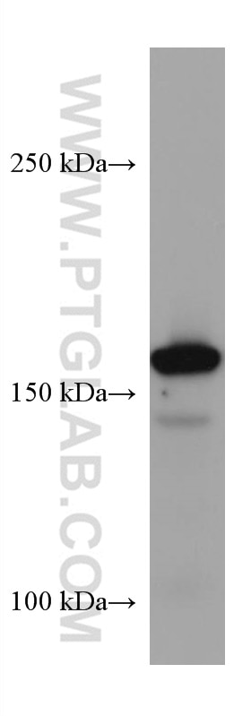 Western Blot (WB) analysis of PC-12 cells using Nestin Monoclonal antibody (66259-1-Ig)