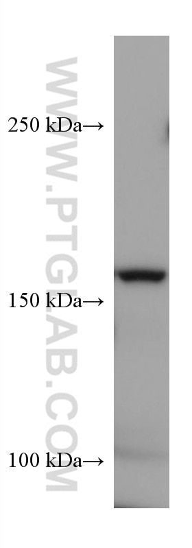 Western Blot (WB) analysis of rat cerebellum tissue using Nestin Monoclonal antibody (66259-1-Ig)