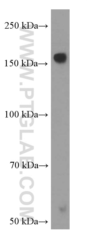 Nestin Antibody 1 Ig Proteintech