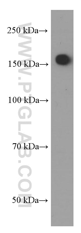 Western Blot (WB) analysis of Neuro-2a cells using Nestin Monoclonal antibody (66259-1-Ig)