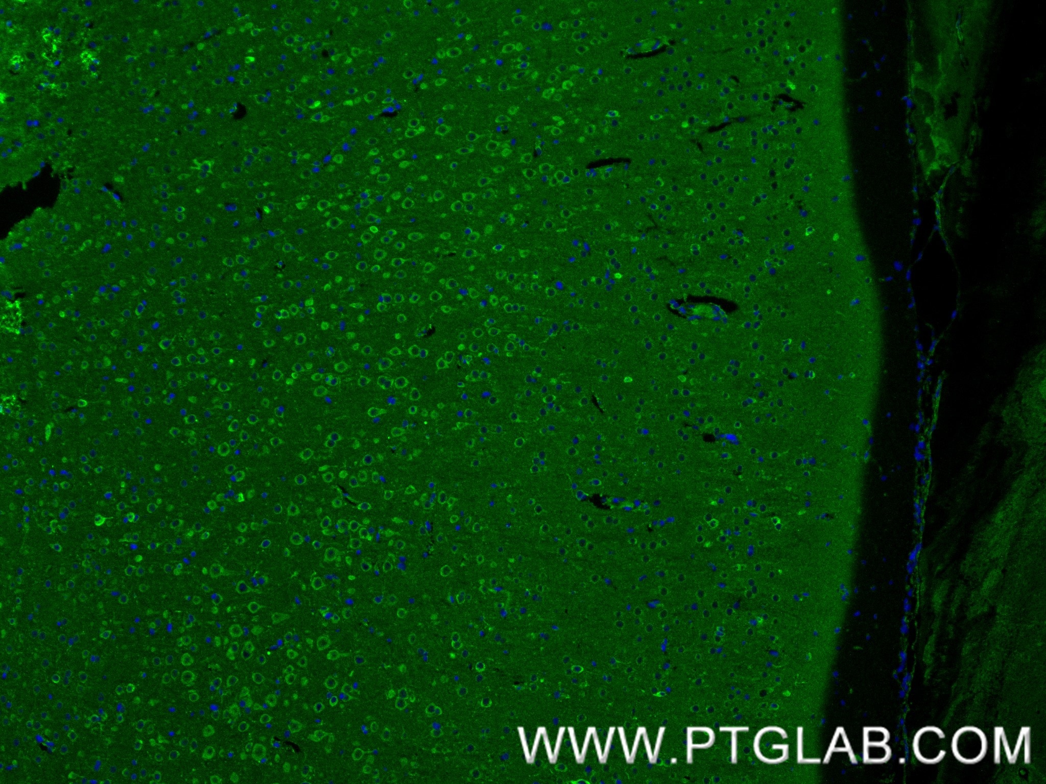 IF Staining of rat brain using 80293-5-RR Immunofluorescence (IF) / fluorescent staining of rat brain tissue using Nestin Recombinant monoclonal antibody (80293-5-RR)