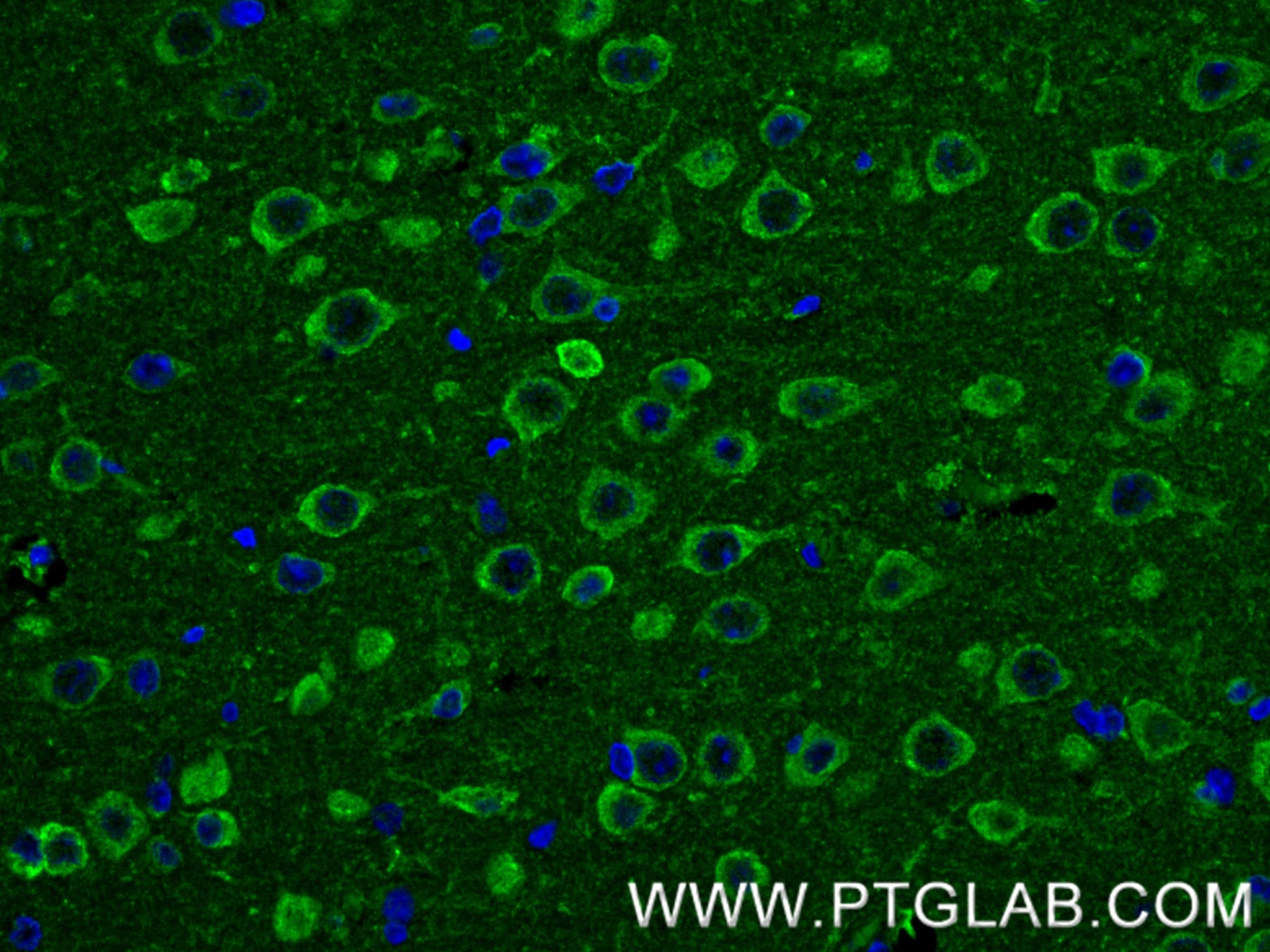 IF Staining of rat brain using 80293-5-RR Immunofluorescence (IF) / fluorescent staining of rat brain tissue using Nestin Recombinant monoclonal antibody (80293-5-RR)