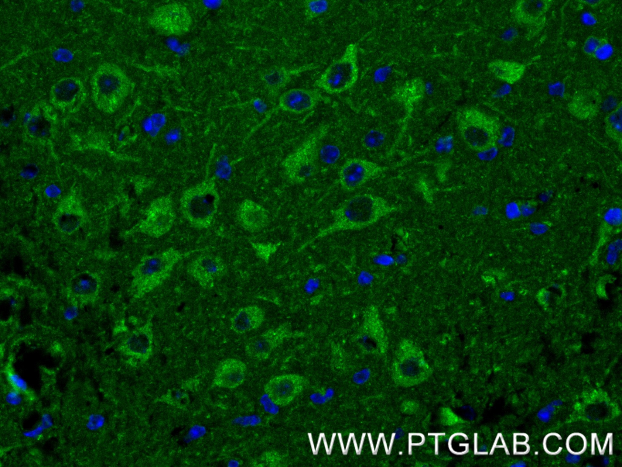 IF Staining of mouse brain using 80293-5-RR Immunofluorescence (IF) / fluorescent staining of mouse brain tissue using Nestin Recombinant monoclonal antibody (80293-5-RR)