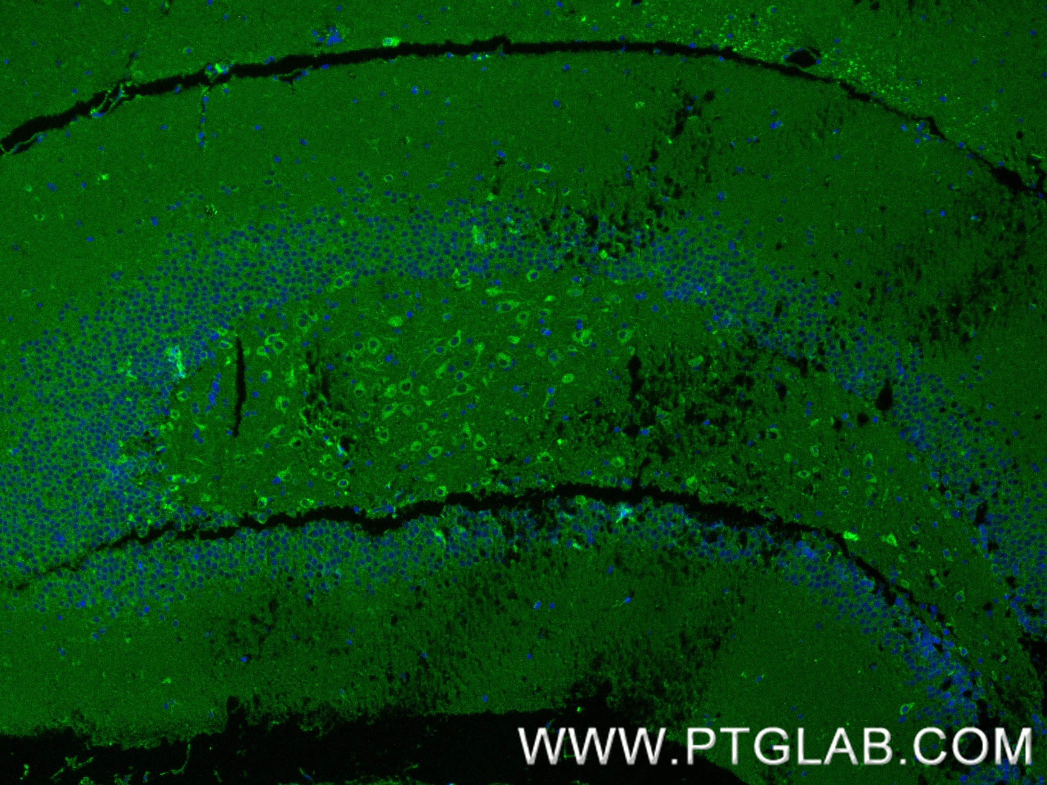IF Staining of mouse brain using 80293-5-RR Immunofluorescence (IF) / fluorescent staining of mouse brain tissue using Nestin Recombinant monoclonal antibody (80293-5-RR)