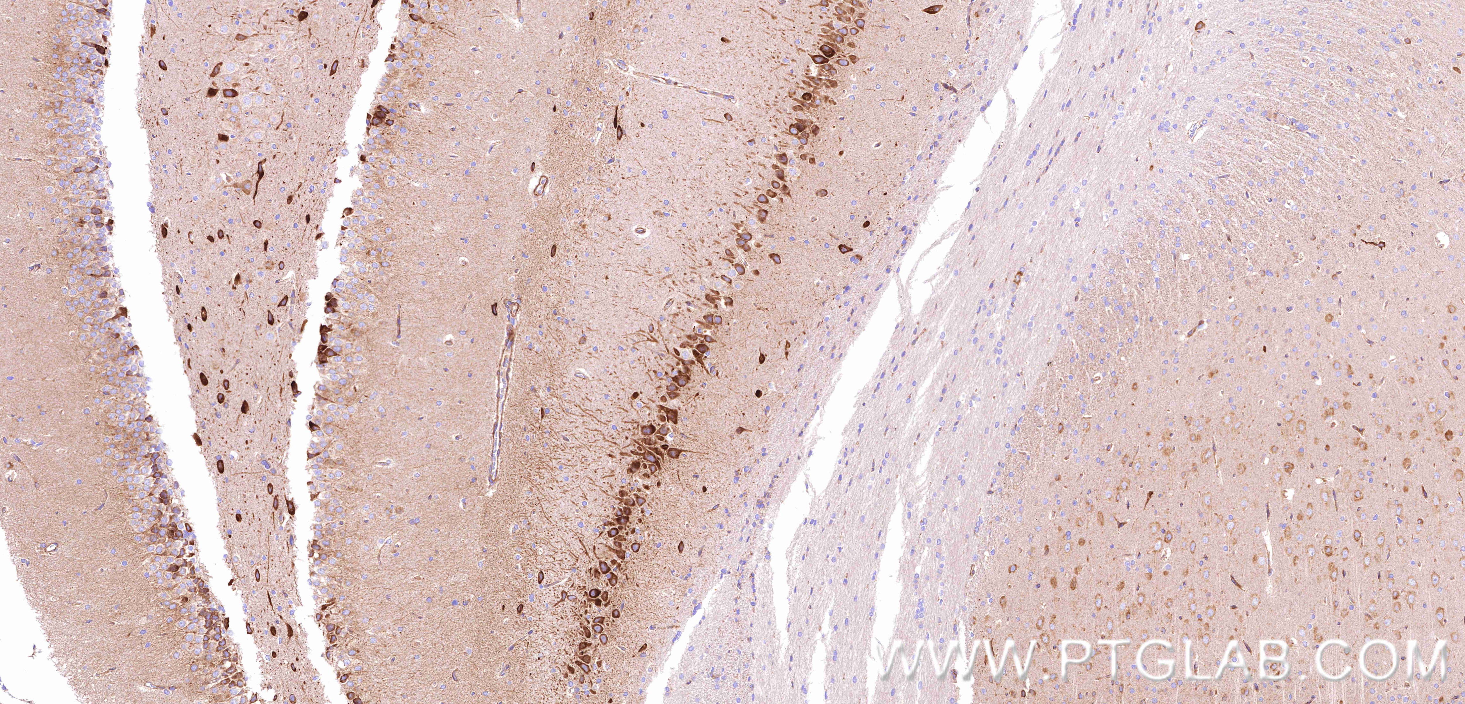 IHC staining of rat brain using 80293-5-RR Immunohistochemistry (IHC) staining of rat brain tissue using Nestin Recombinant monoclonal antibody (80293-5-RR)