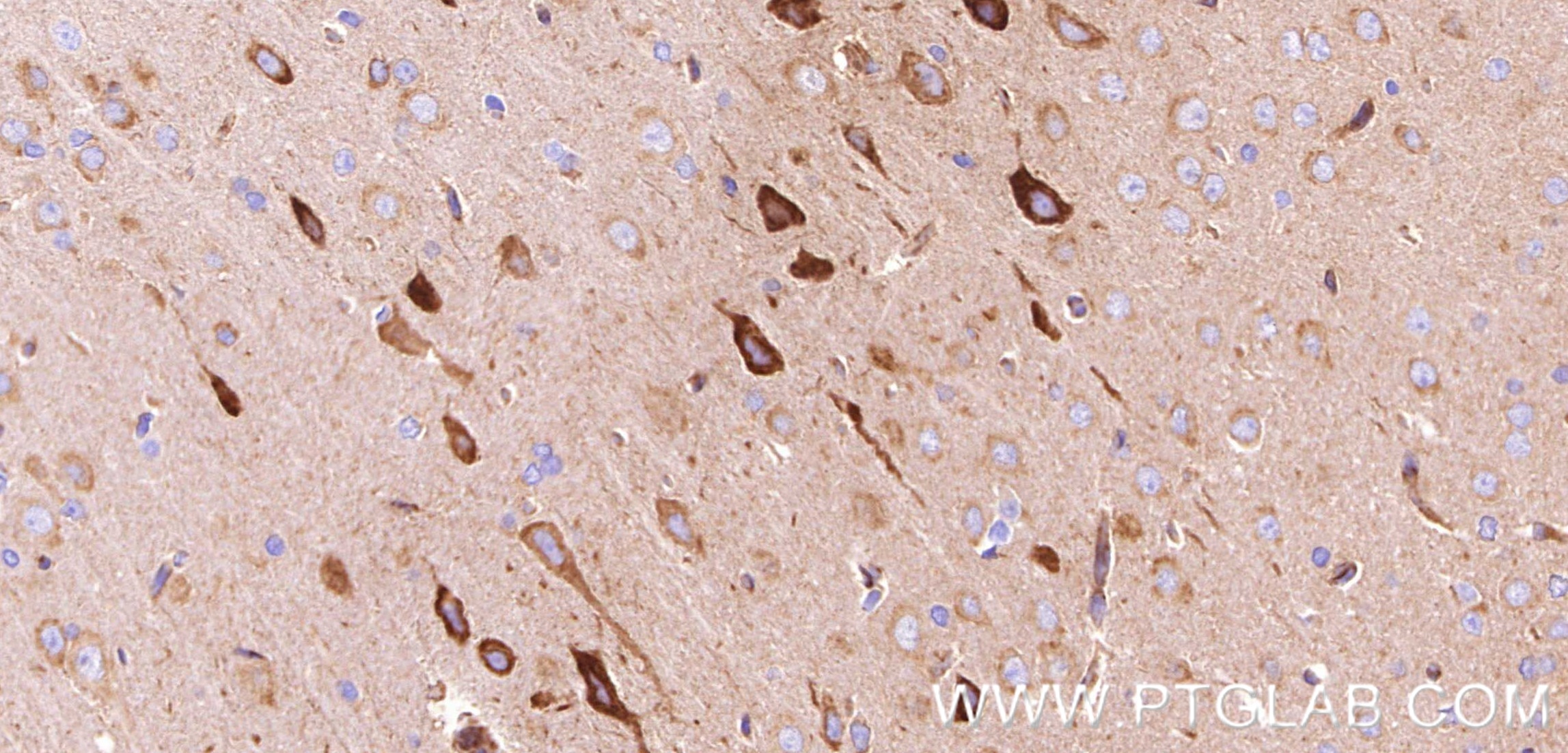 IHC staining of rat brain using 80293-5-RR Immunohistochemistry (IHC) staining of rat brain tissue using Nestin Recombinant monoclonal antibody (80293-5-RR)