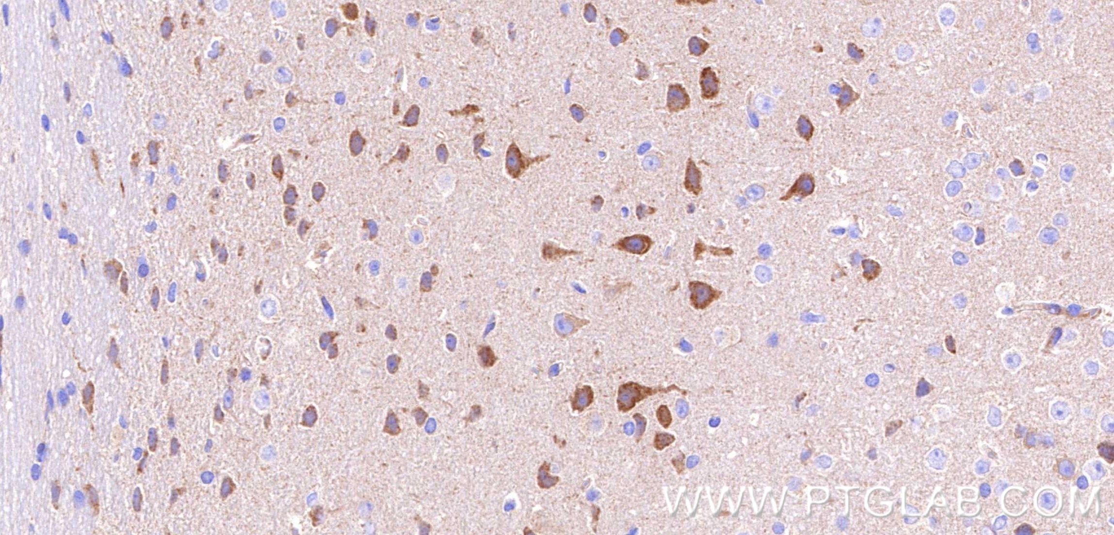 IHC staining of mouse brain using 80293-5-RR Immunohistochemistry (IHC) staining of mouse brain tissue using Nestin Recombinant monoclonal antibody (80293-5-RR)