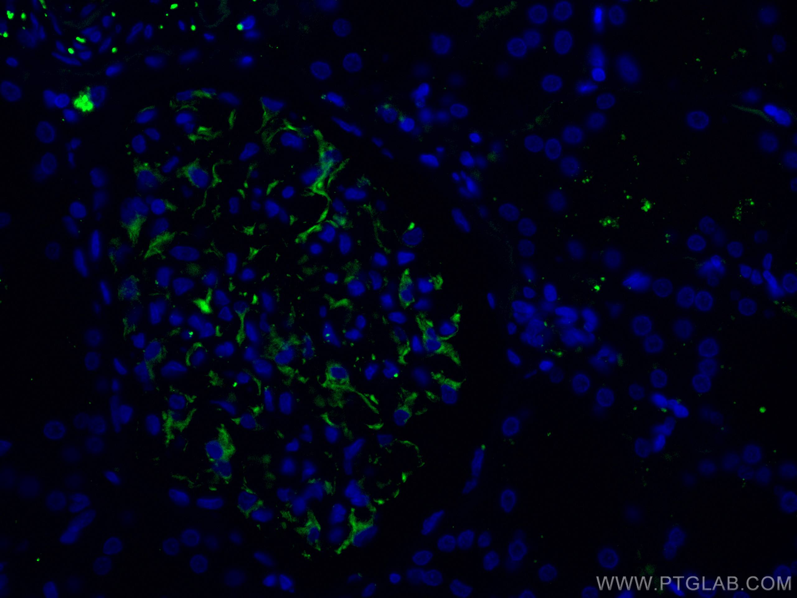 Immunofluorescence (IF) / fluorescent staining of human kidney tissue using CoraLite® Plus 488-conjugated Nestin Polyclonal an (CL488-19483)