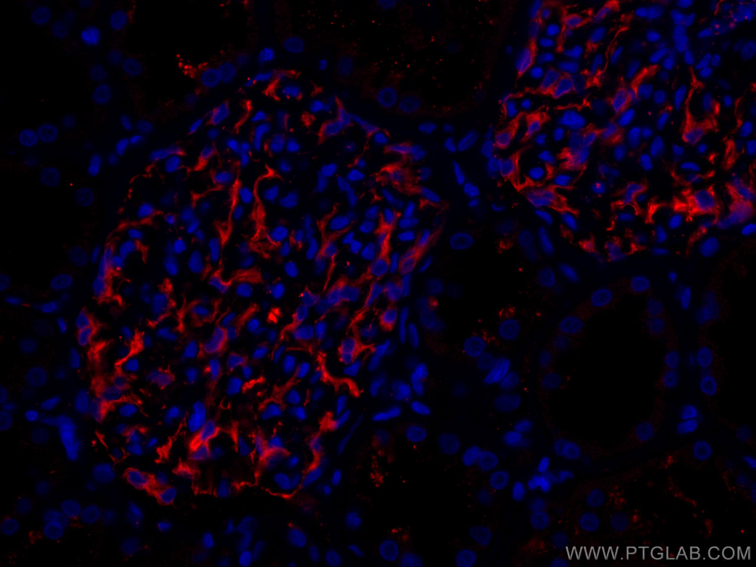 Immunofluorescence (IF) / fluorescent staining of human kidney tissue using CoraLite®594-conjugated Nestin Polyclonal antibody (CL594-19483)