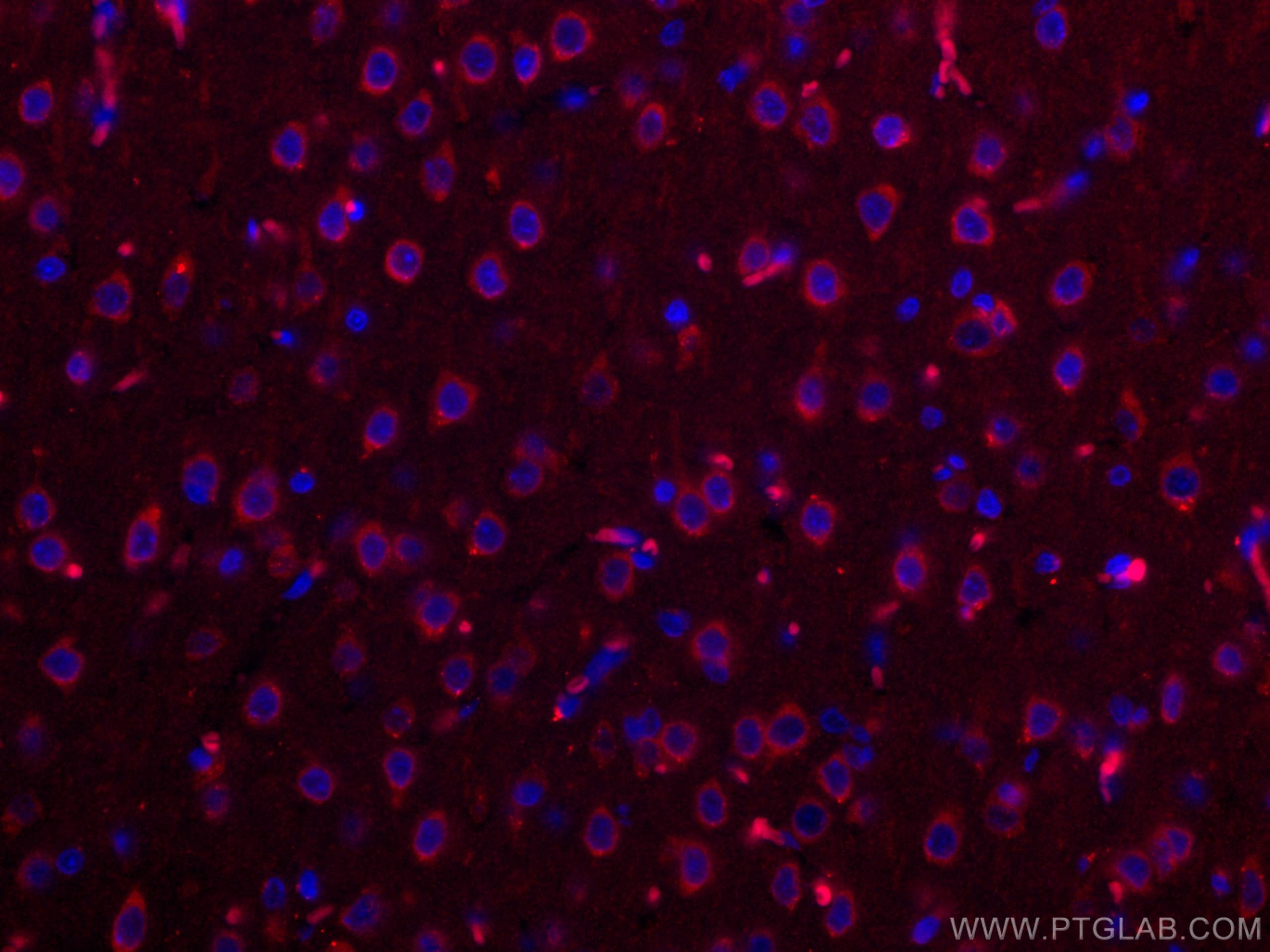 IF Staining of rat brain using CL594-19483