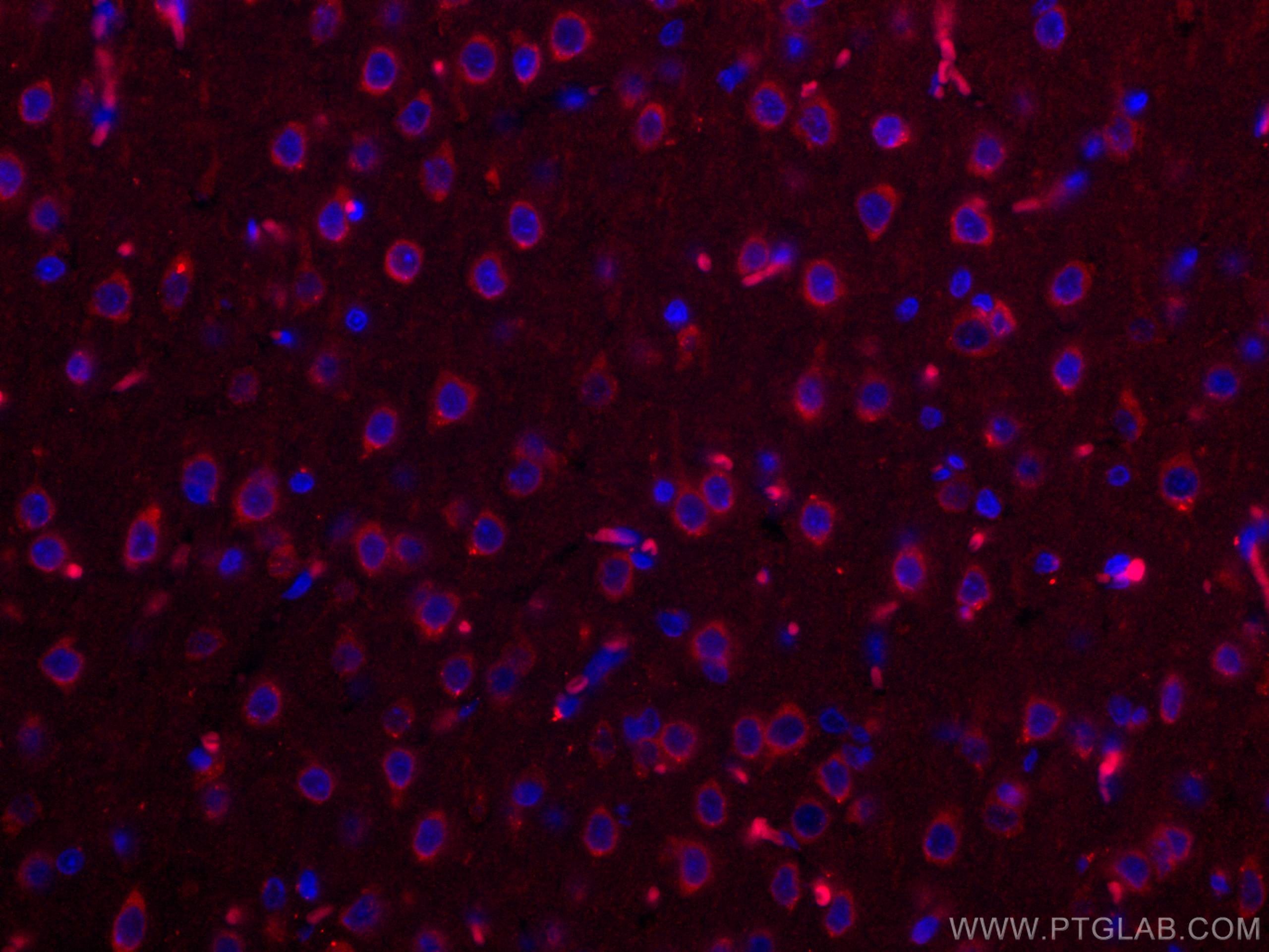 Immunofluorescence (IF) / fluorescent staining of rat brain tissue using CoraLite®594-conjugated Nestin Polyclonal antibody (CL594-19483)