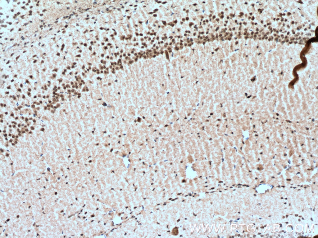 IHC staining of mouse brain using 23060-1-AP
