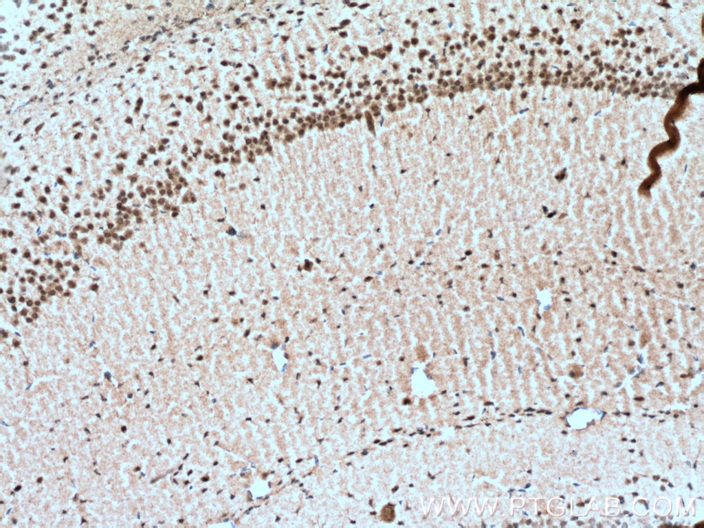 Immunohistochemistry (IHC) staining of mouse brain tissue using NeuN Polyclonal antibody (23060-1-AP)