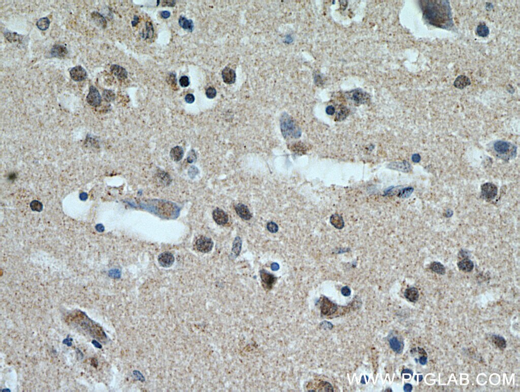 NeuN Polyclonal antibody