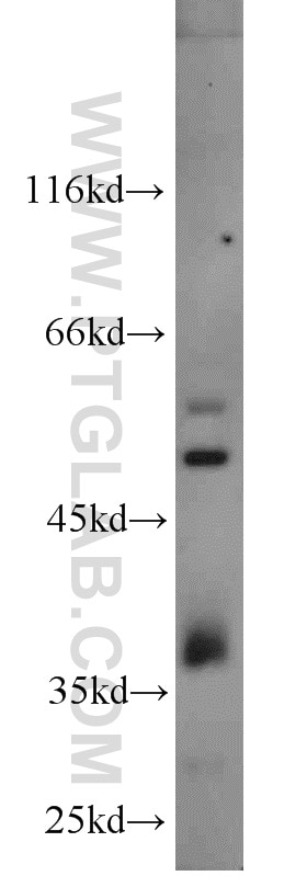 WB analysis of 3T3-L1 using 23060-1-AP