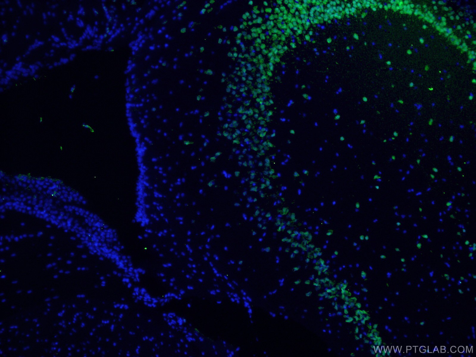Immunofluorescence (IF) / fluorescent staining of mouse brain tissue using NeuN Polyclonal antibody (26975-1-AP)