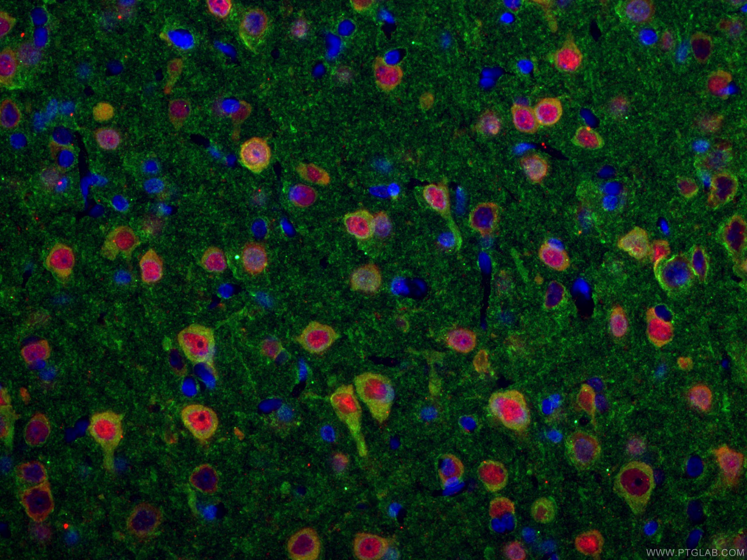 IF Staining of rat brain using 26975-1-AP