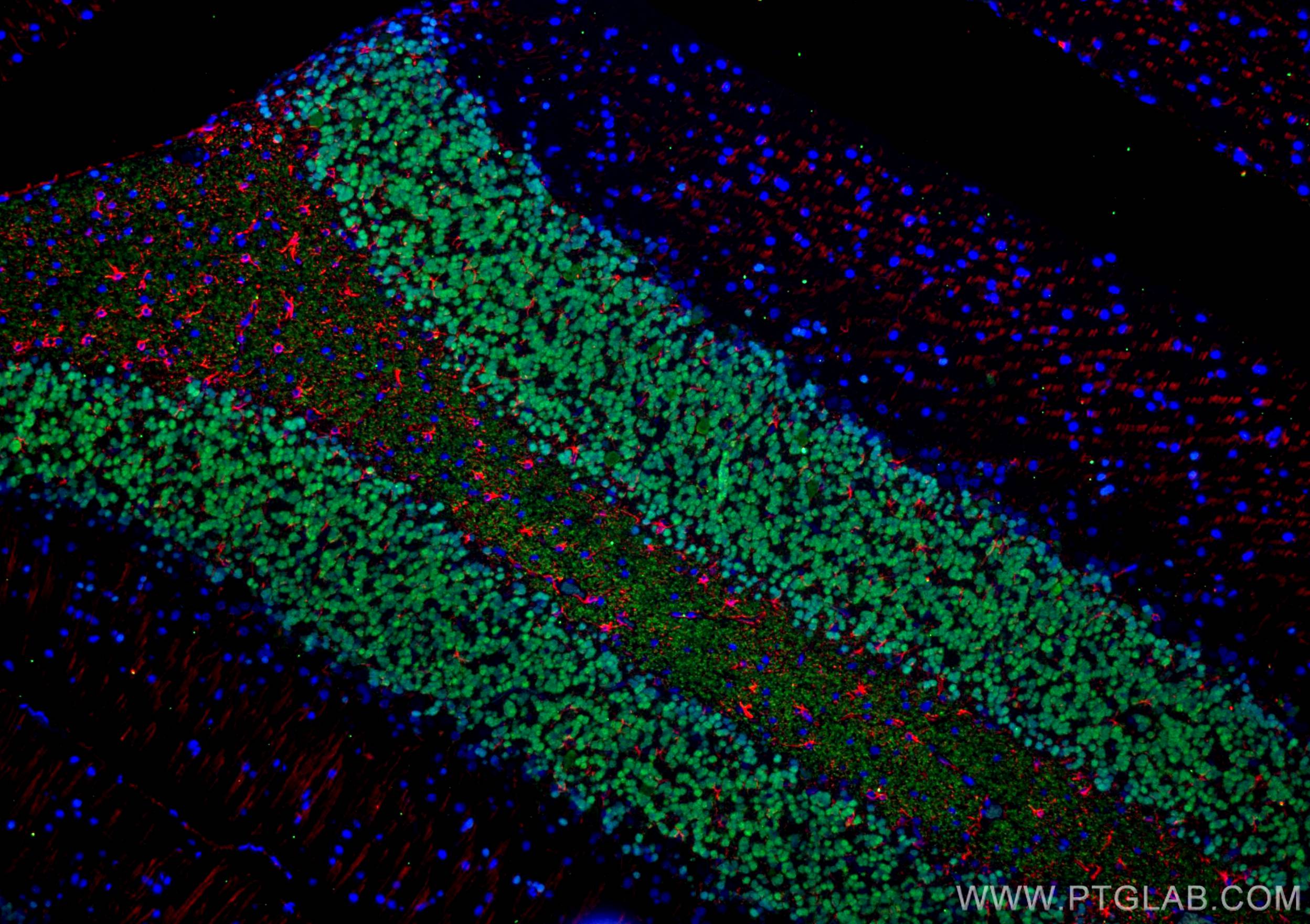 IF Staining of rat cerebellum using 26975-1-AP